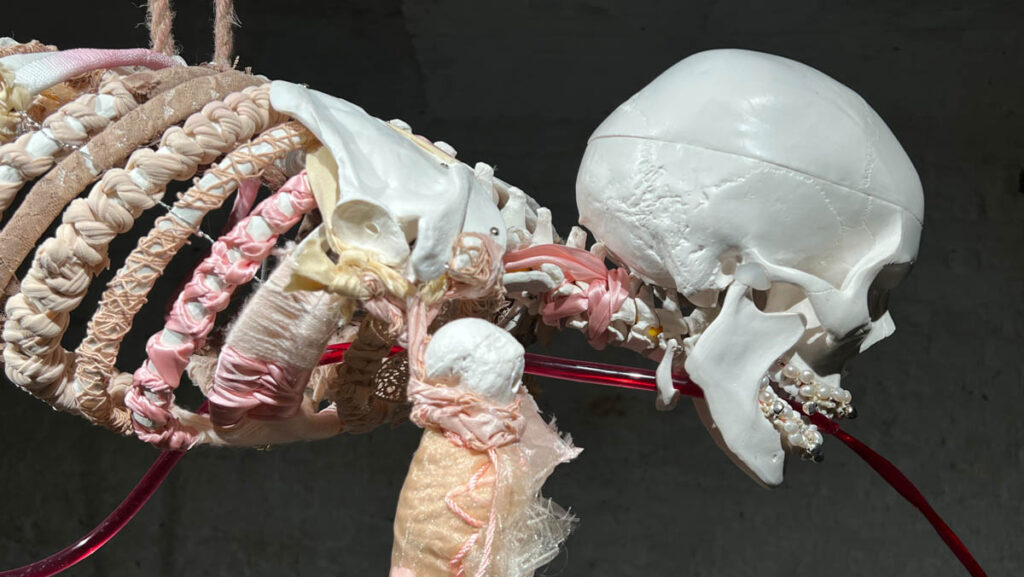 post-radical Viennese actionist