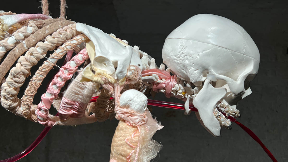 post-radical Viennese actionist